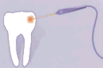 کاربردهای پزشکی در دندان